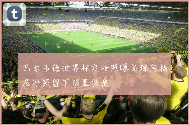 巴尔韦德世界杯定妆照曝光琼阿梅尼冲突留下明显伤痕